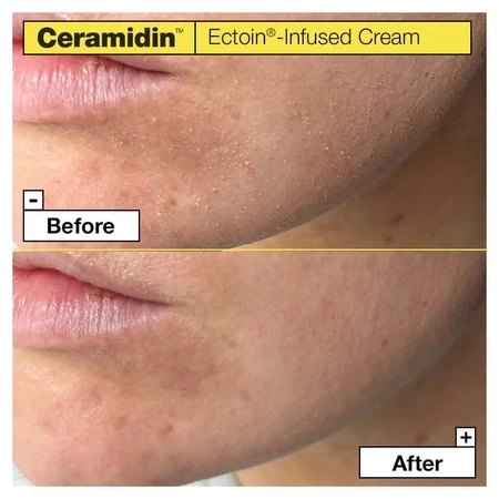 Dr.jart+ Ceramidin Ectoin-infused Cream 50 ml