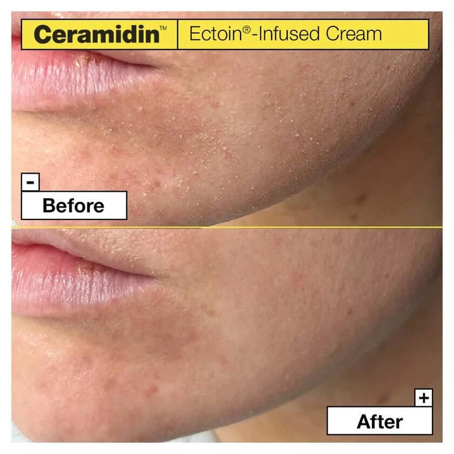 Dr.jart+ Ceramidin Ectoin-infused Cream 50 ml