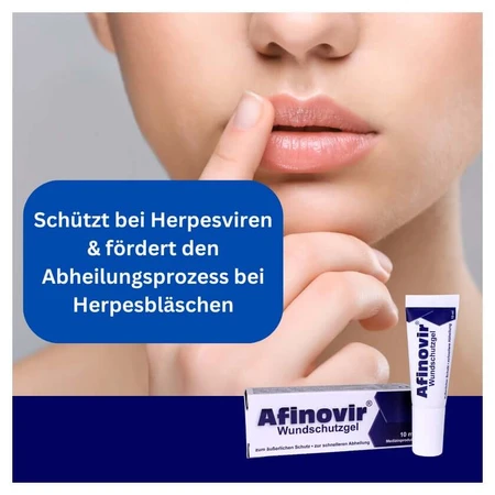 Afinovir wound protection gel 10 ml