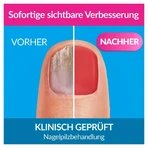 Excilor Nail Fungus Intensive Color 30 Ml+8 Ml Combi. 1 P