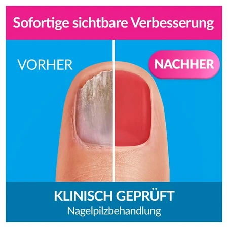 Excilor Nail Fungus Intensive Color 30 Ml+8 Ml Combi. 1 P