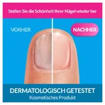 Excilor Regenerierendes Nagelserum 10 ml