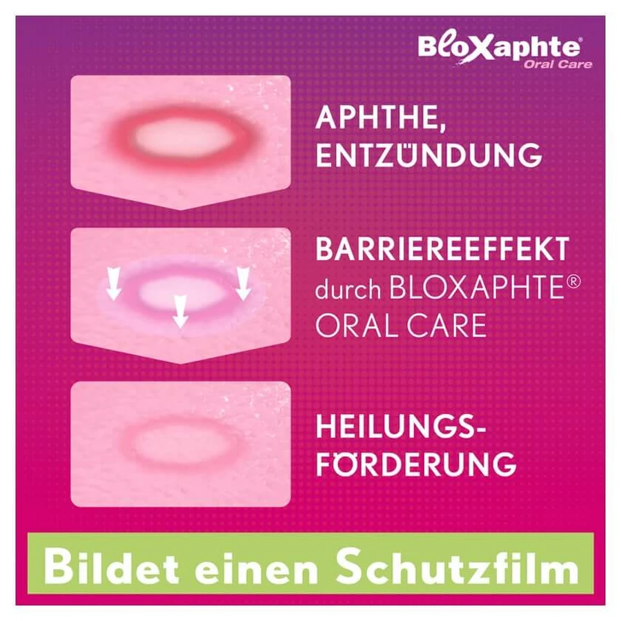 Bloxaphte Oral Care Mouth Spray 20 ml