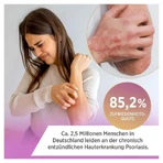 ALNOVAT Cream 50 g