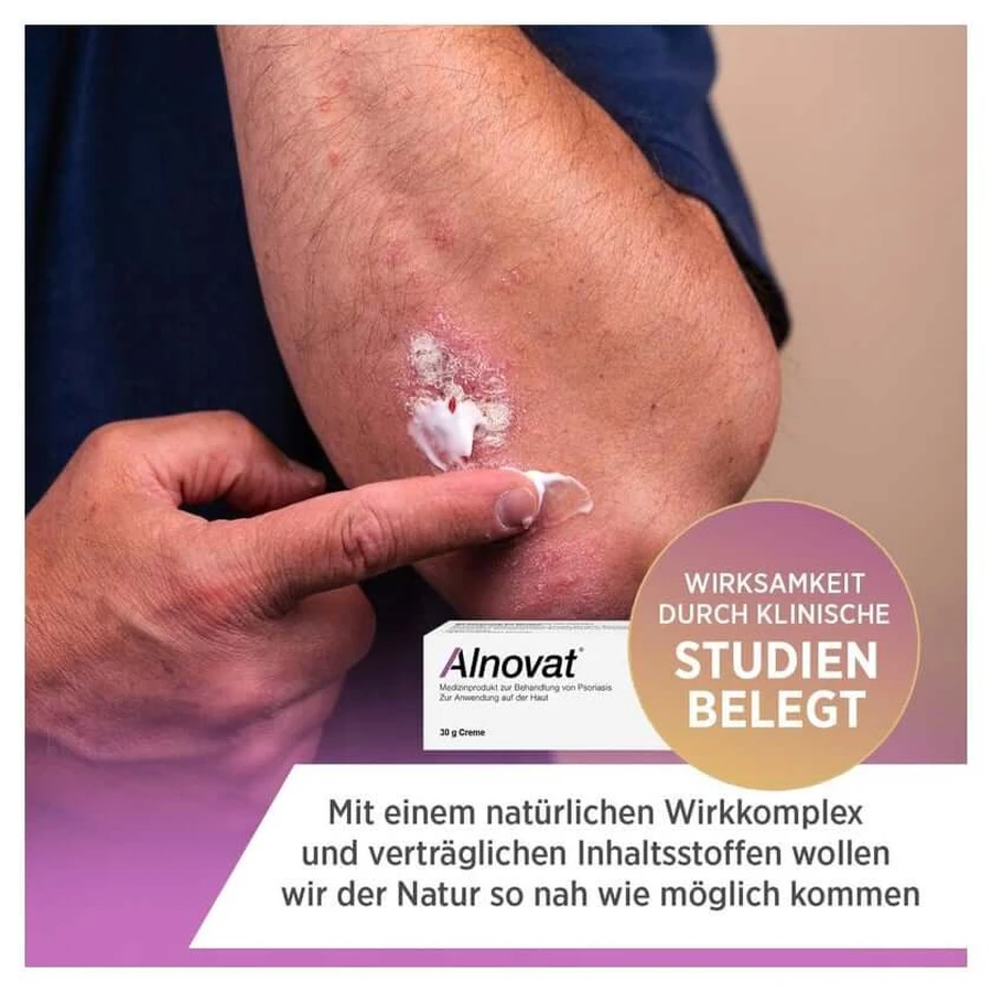ALNOVAT Cream 50 g
