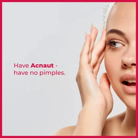 Acne Out Hydro Active Feuchtigkeitscreme, 60 ml, Biotrade 