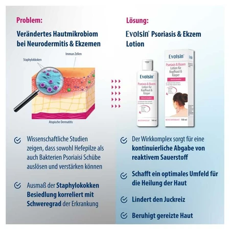 Lotion Evolsin contre le psoriasis et l'eczéma pour le cuir chevelu et le corps, 100 ml