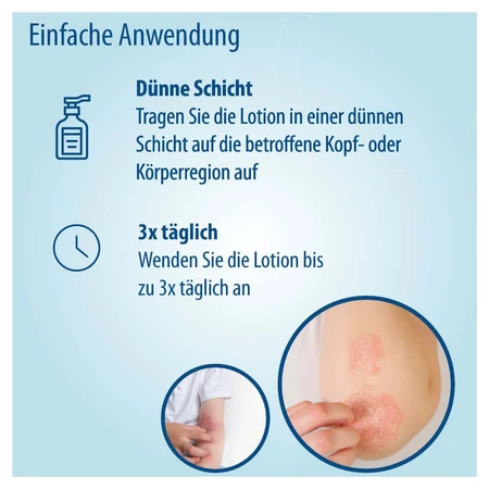 Lotion Evolsin contre le psoriasis et l'eczéma pour le cuir chevelu et le corps, 100 ml