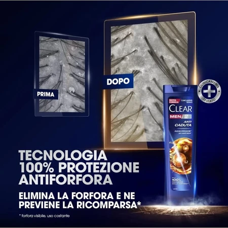 Clear Men Anti-Hair Loss - Anti-Dandruff Shampoo 225 ml