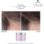 Alterna Renewing Scalp Care Scrub to Foam - Moisturizing Hair Scrub 177 ml