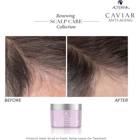 Alterna Renewing Scalp Care Scrub to Foam - Moisturizing Hair Scrub 177 ml