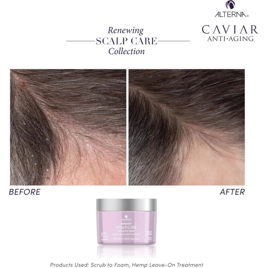 Alterna Renewing Scalp Care Scrub to Foam - Moisturizing Hair Scrub 177 ml