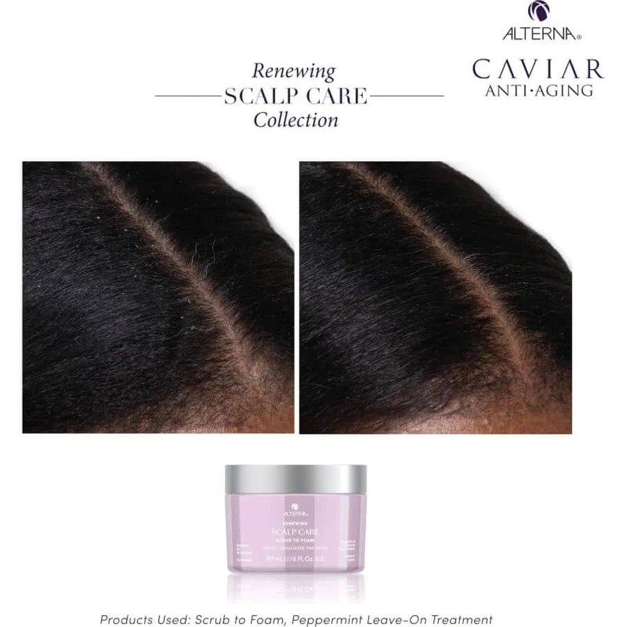 Alterna Renewing Scalp Care Scrub to Foam - Moisturizing Hair Scrub 177 ml