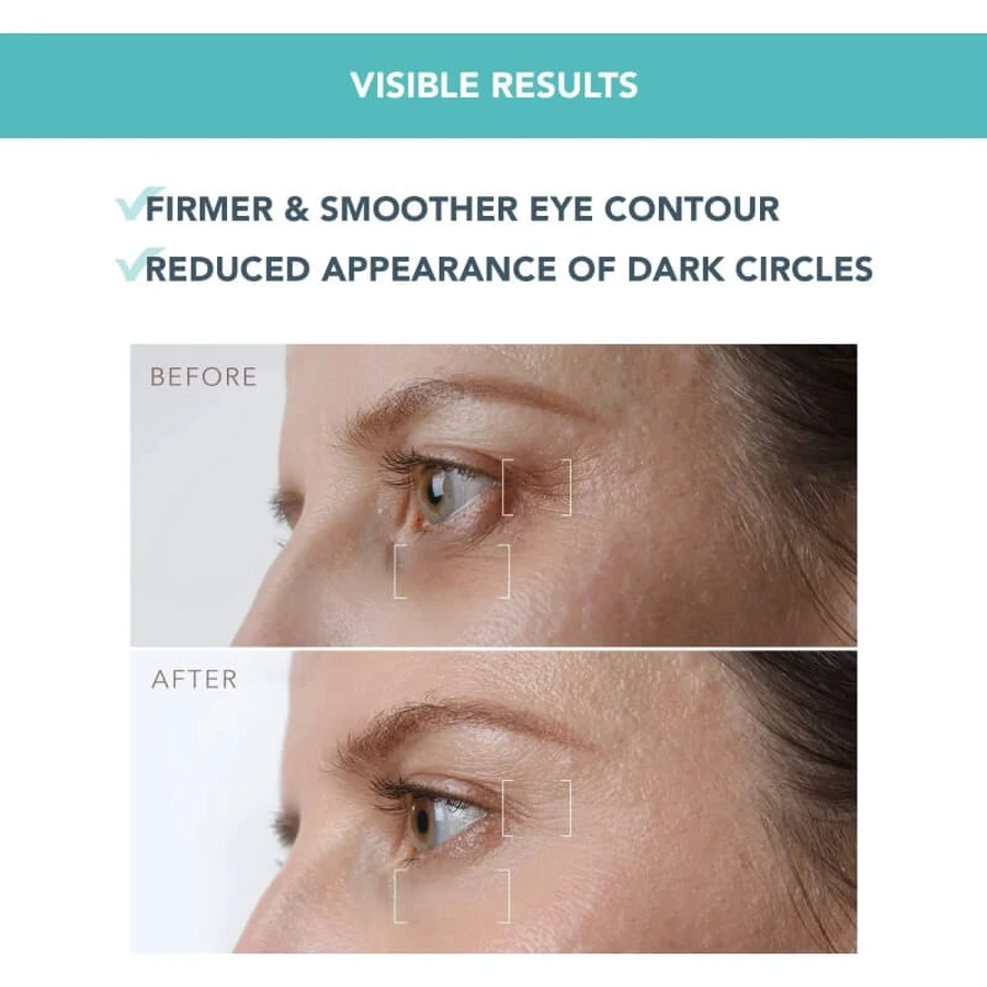 Foreo Iris Firming PM - Eye Contour Serum 15 ml