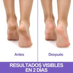 Crema regeneradora Podovis para talones agrietados, 75 ml