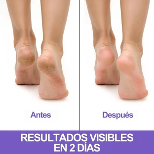 Crema regeneradora Podovis para talones agrietados, 75 ml