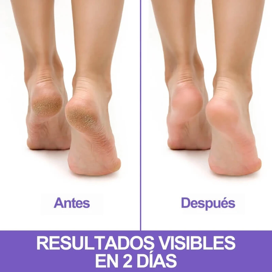 Crema regeneradora Podovis para talones agrietados, 75 ml