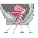 Vagisan Vaginal Moisturizing Cream, 25 g, Dr. Wolff