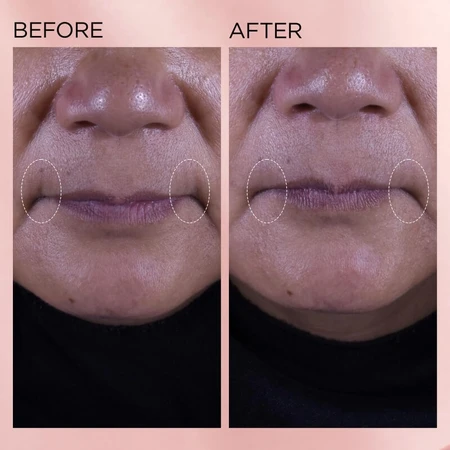 Elizabeth Arden Retinol + HPR Ceramide Crema hidratante renovadora rápida - Crema hidratante regeneradora 50 ml