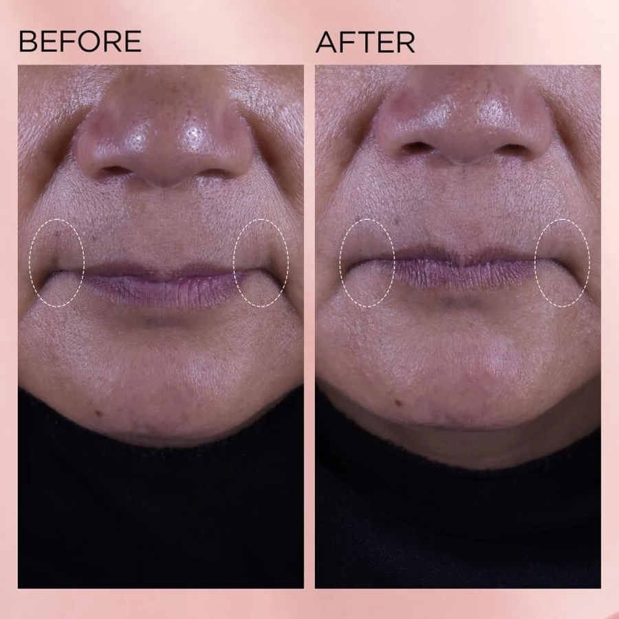 Elizabeth Arden Retinol + HPR Ceramide Crema hidratante renovadora rápida - Crema hidratante regeneradora 50 ml