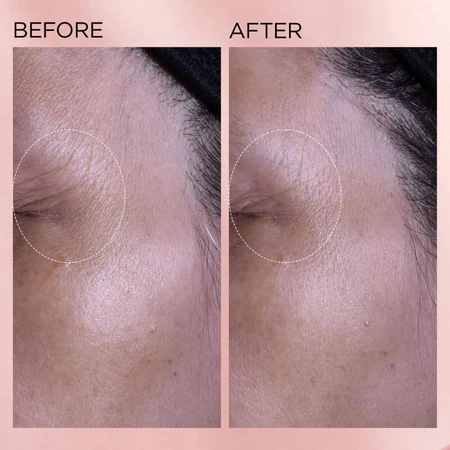 Elizabeth Arden Retinol + HPR Ceramide Crema hidratante renovadora rápida - Crema hidratante regeneradora 50 ml