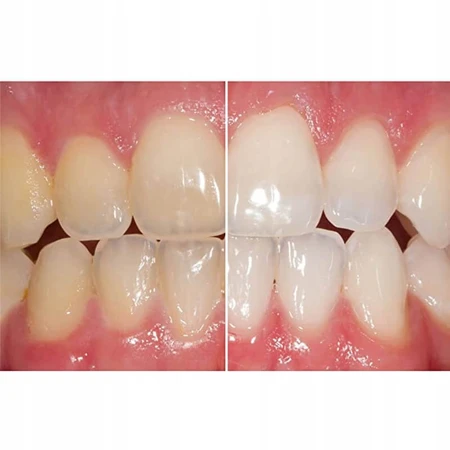 Whitening Toothpaste Opalescence Cool Mint, 133 g, Ultradent