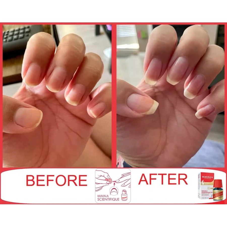 Mavala Scientifique k+ – Nagelhärter 5 ml