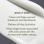 Origins Clear Improvement: Loción hidratante para eliminar imperfecciones - Loción hidratante antiimperfecciones, 50 ml