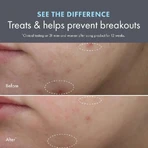 Origins Clear Improvement: Loción hidratante para eliminar imperfecciones - Loción hidratante antiimperfecciones, 50 ml
