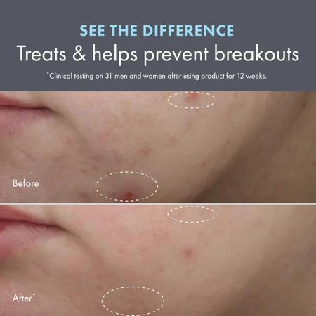 Origins Clear Improvement: Loción hidratante para eliminar imperfecciones - Loción hidratante antiimperfecciones, 50 ml