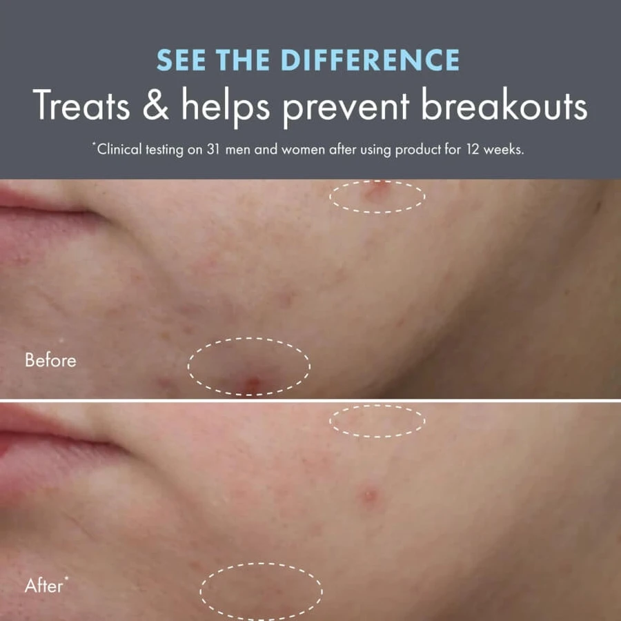 Origins Clear Improvement: Loción hidratante para eliminar imperfecciones - Loción hidratante antiimperfecciones, 50 ml