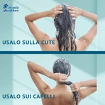Head &amp; Shoulders Dermaxpro - Acondicionador calmante para el cuero cabelludo y el cabello, 220 ml