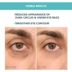 Foreo Iris C - Crème éclaircissante concentrée pour le contour des yeux - Crème éclaircissante pour le contour des yeux 15 ml