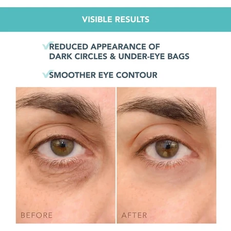 Foreo Iris C - Crème éclaircissante concentrée pour le contour des yeux - Crème éclaircissante pour le contour des yeux 15 ml
