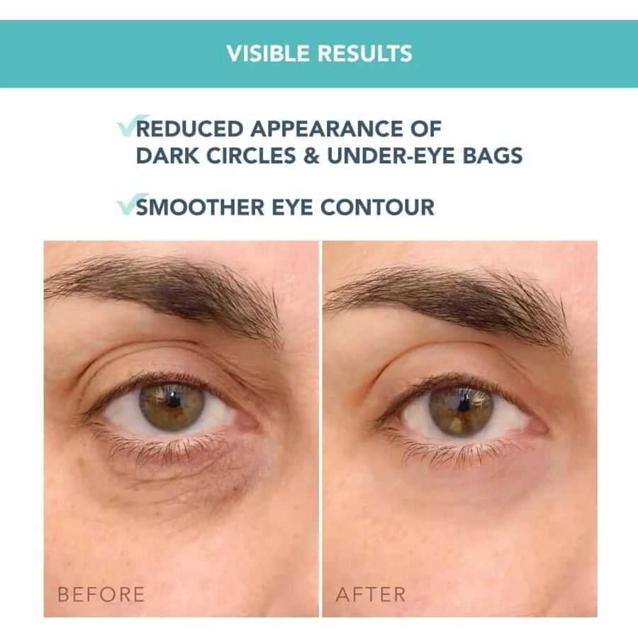 Foreo Iris C - Crème éclaircissante concentrée pour le contour des yeux - Crème éclaircissante pour le contour des yeux 15 ml