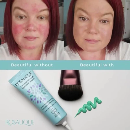Rosalique 3-in-1 Anti-Redness SPF 50 Miracle Formula - Anti-Redness Face Cream 30 ml