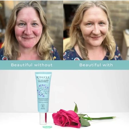 Rosalique 3-in-1 Anti-Redness SPF 50 Miracle Formula - Anti-Redness Face Cream 30 ml