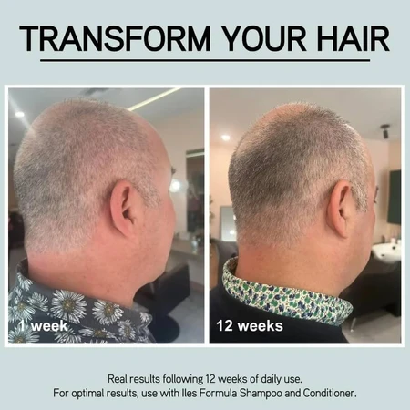 Iles Formula Grey Delay Booster - Treatment for Gray Hair, 50 ml