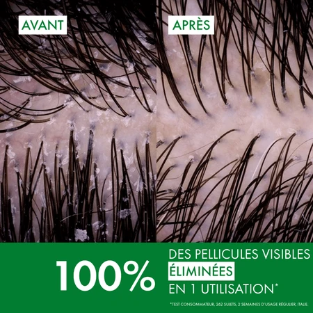 Champú de tratamiento anticaspa Vichy Dercos DS para cabello seco, recambio ecológico, 390 ml