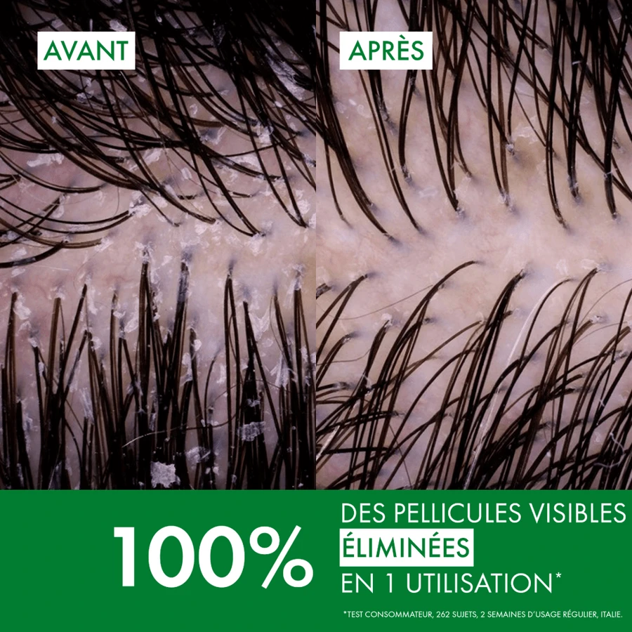 Champú de tratamiento anticaspa Vichy Dercos DS para cabello seco, recambio ecológico, 390 ml