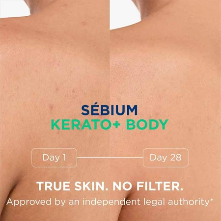 Sebium Kerato+ Körperspray, 2 × 150 ml, Bioderma 