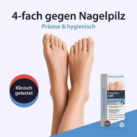 Acetocaustin-nagelschimmelpen voor de behandeling van nagelschimmel, pennen van 4 ml