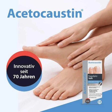 Acetocaustin-nagelschimmelpen voor de behandeling van nagelschimmel, pennen van 4 ml