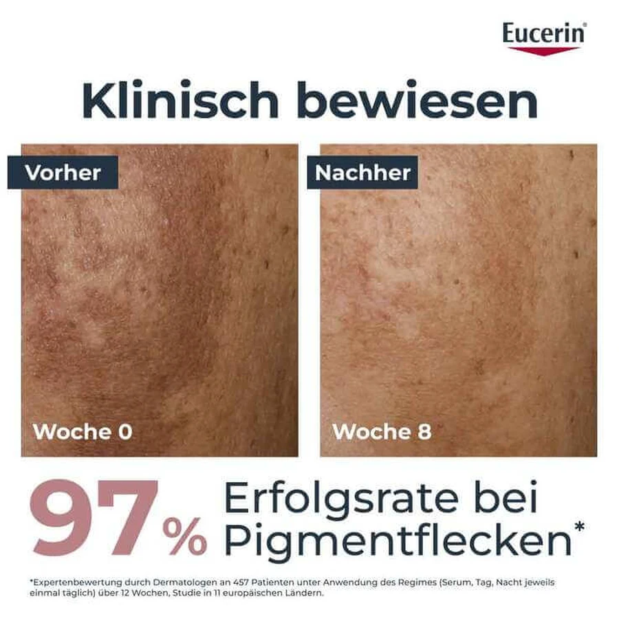Eucerin Anti-Pigment Dual Serum – Donkere vlekken, 2 x 30 ml crème