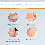 Solution EndWarts® CLASSIC, 3 ml de solution