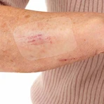 Leukomed® T Skin Sensitive 8x10 cm, 5-pack of bandages