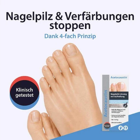 Acetocaustin Nail Fungus Solution with Whitening, 9 ml solution