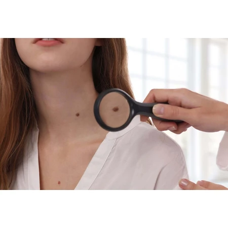 Crème Aktin pour le traitement de la kératose actinique et des lésions précancéreuses, 2 x 30 ml, Solartium