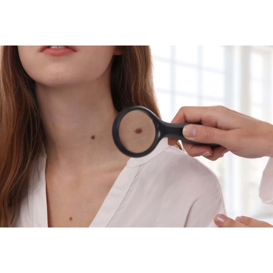 Crème Aktin pour le traitement de la kératose actinique et des lésions précancéreuses, 2 x 30 ml, Solartium