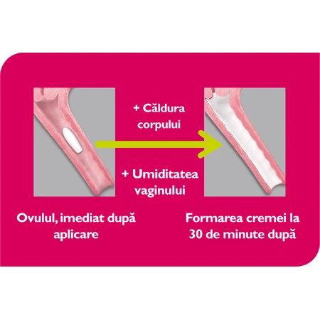 Vagisan Milchsäure-Vaginalzäpfchen, 2 × 7 Stück, Vagisan